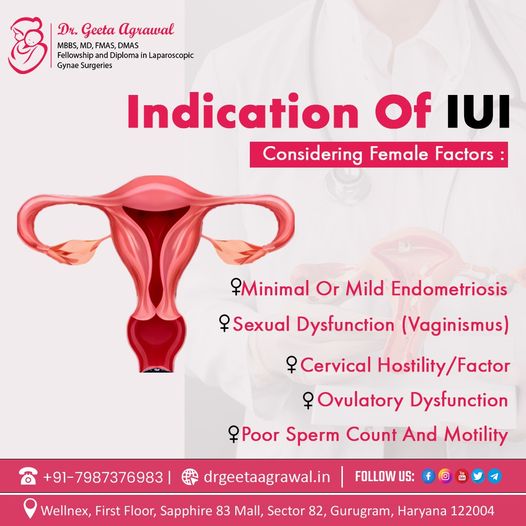 IUI Treatment Specialist